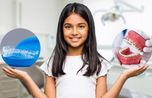 Braces vs Clear Aligners