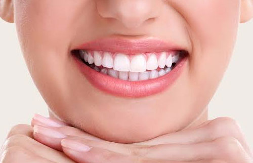 Smile Makeover