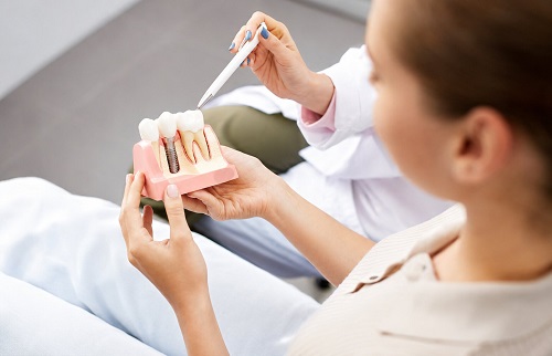 Best Dental Implant Doctor in Ghatkopar West