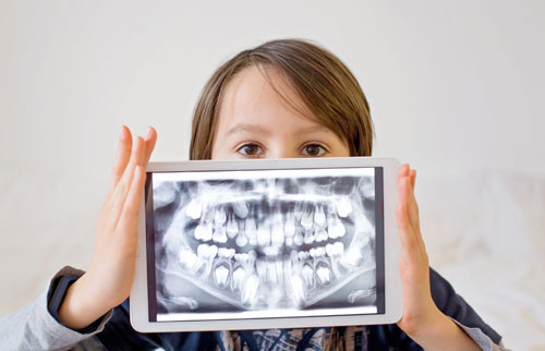Dental X-Rays