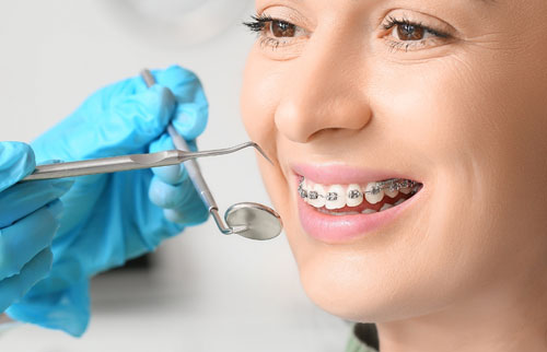 Orthodontic Treatment / Braces / Aligners